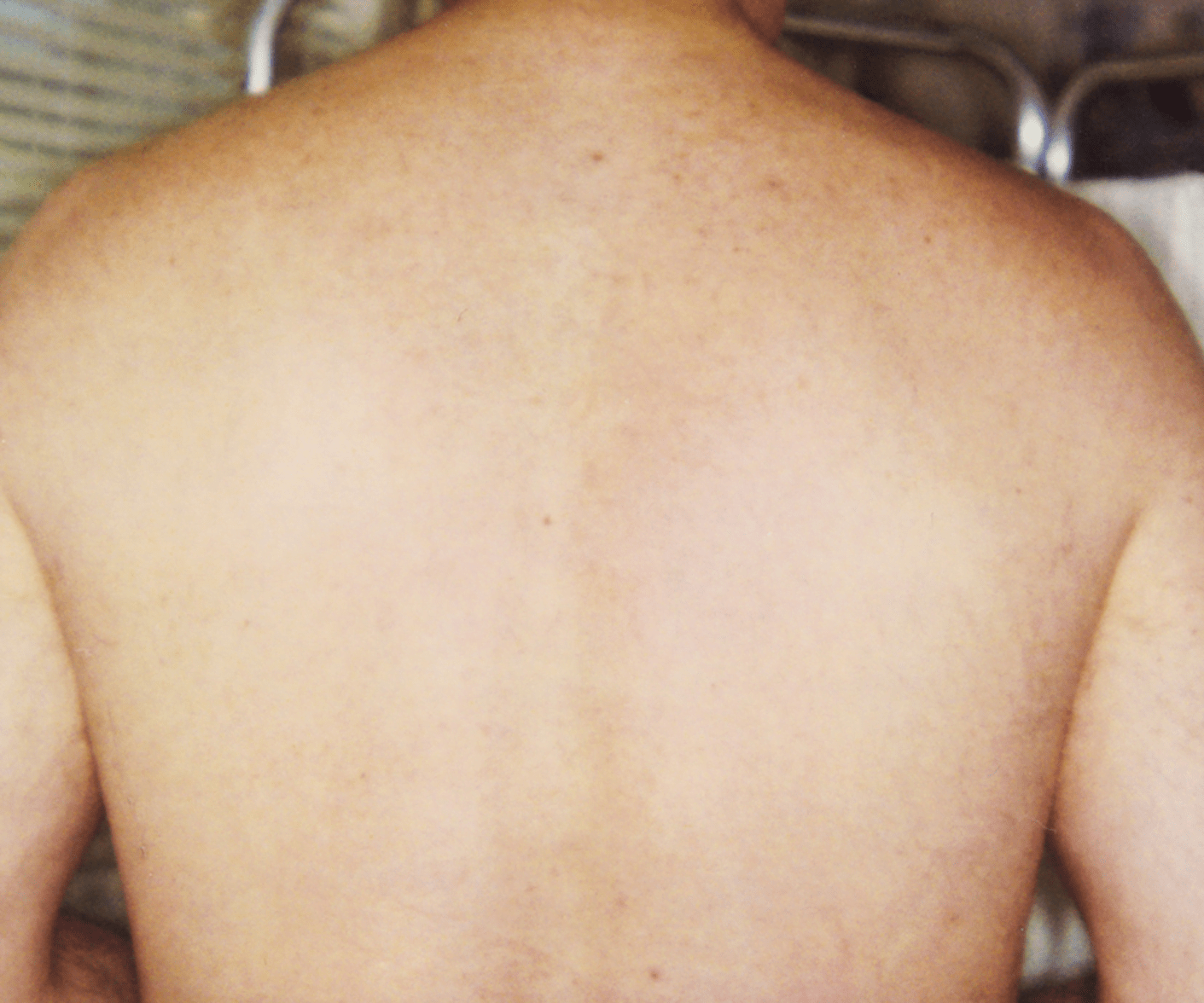 GentleMax_gallery_ba_after_17