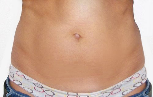 ultraskin1